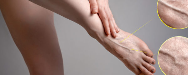 heaviness in legs